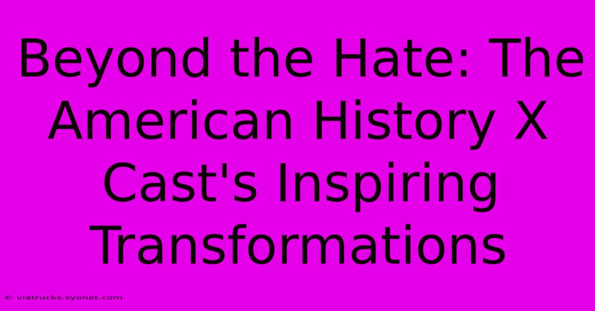 Beyond The Hate: The American History X Cast's Inspiring Transformations